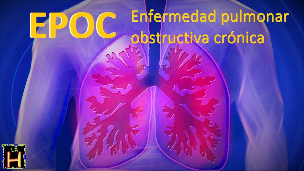 La enfermedad pulmonar obstructiva crónica (EPOC) se caracteriza por un bloqueo persistente del flujo de aire. Se trata de una enfermedad subdiagnosticada y potencialmente mortal que altera la respiración normal y no es totalmente reversible. Los términos bronquitis crónica y enfisema están anticuados, quedando englobados en el diagnóstico de EPOC. Los síntomas más frecuentes de la EPOC son:- La falta de aire o dificultad para respirar o disnea.- la expectoración anormal -y la tos crónica. oc