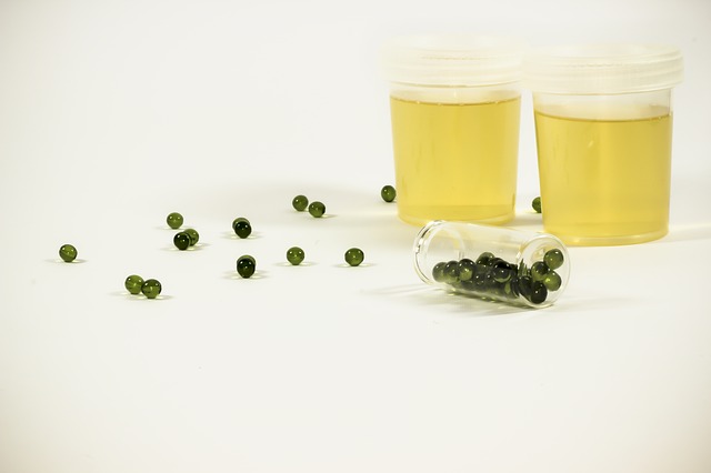 analisis vejiga hiperactiva