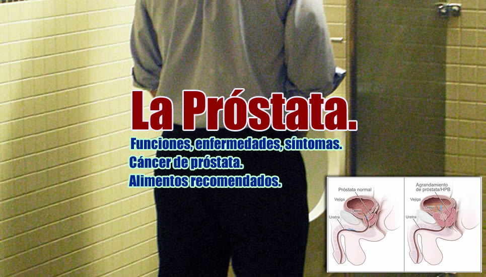 cáncer de próstata portada