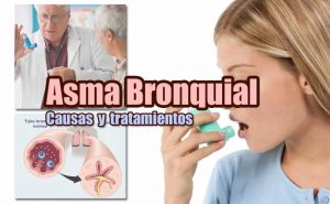 asma bronquial portada