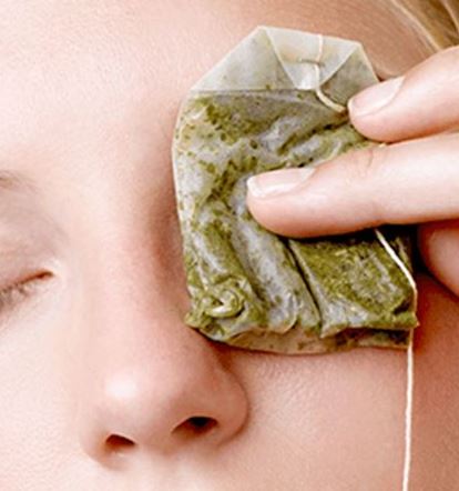 remedios para el orzuelo