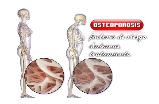 factores de riesgo. síntomas. tratamiento.