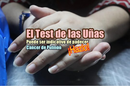 Test de las uñas y cáncer de pulmón