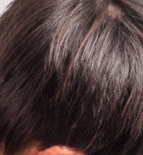 foto del cabello de una mujer adulta visto desde un lateral